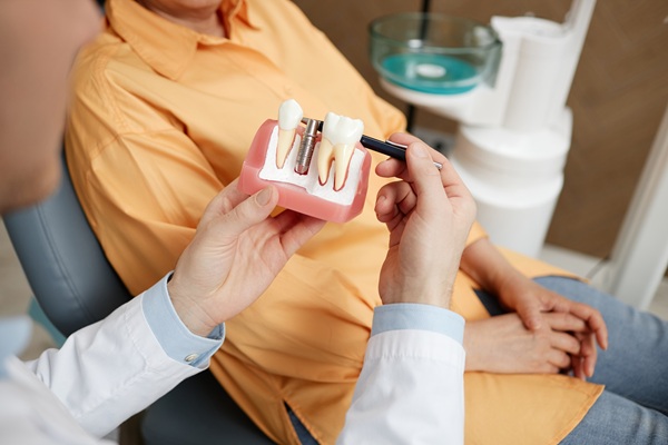 How Dental Implants Can Help Your Jawbone