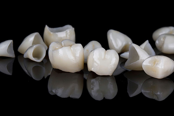 What Are the Differences Between a Dental Crown and a Dental Veneer? from R. David Brumbaugh, DDS in Dallas, TX