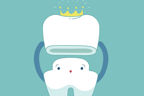 How Common Is Dental Crown Replacement? from R. David Brumbaugh, DDS in Dallas, TX